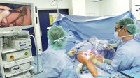Chirurgen messen Durchblutung mit fluoreszierendem